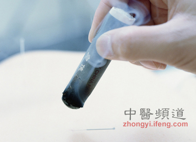 點擊將在新窗口查看全圖 小孩也可以艾灸保健 但要注意5點