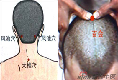 常見病艾灸時怎樣選穴？--大椎百會穴