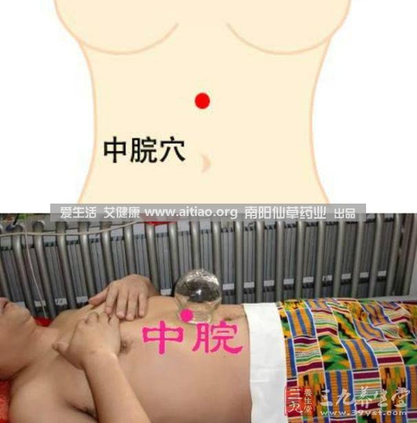 中脘穴位于腹部正中線，臍上4寸的位置上。每天艾灸10-15分鐘，能有效緩解胃部不適的癥狀，同時(shí)有助于祛濕。